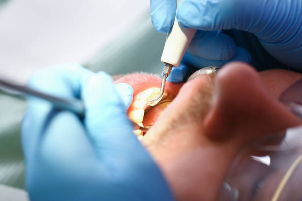Best Root Canal Emergency Dentist  in Mannington, WV